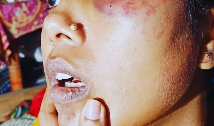 সৈয়দপুরে যৌতুক লোভী স্বামীর নির্যাতনের শিকার গৃহবধূ