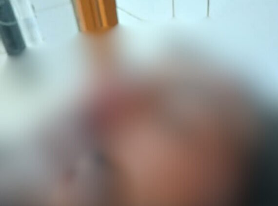 নড়াইলে পুর্ব শত্রুতার জেরে দুইজনকে কুপিয়ে জখম,আটক ১