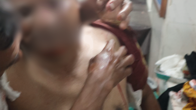 কুমিল্লা তিতাস উপজেলায় সোলাকান্দি গ্রামে সেলিম মোল্লা কে কুপিয়ে মারাত্মক যখম