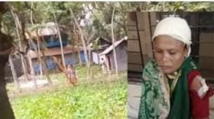 দুমকি উপজেলায়,  জমিজমার বিরোধে নারীকে মারধর ও প্রাণনাশের হুমকি