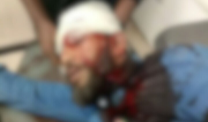 খুলনায় এনসিপি নেতা গুলিবিদ্ধ : আশঙ্কাজনক অবস্থায় খুলনা মেডিকেল কলেজ হাসপাতালে ভর্তি করা হয়েছে