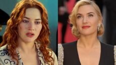 প্লাস্টিক সার্জারি নিয়ে যে কঠোর সমালোচনা করলেন কেট উইন্সলেট