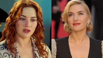 প্লাস্টিক সার্জারি নিয়ে যে কঠোর সমালোচনা করলেন কেট উইন্সলেট