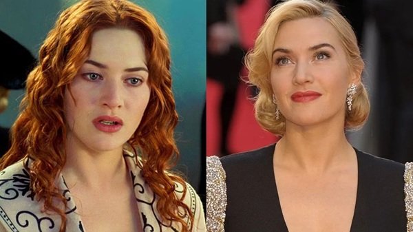 প্লাস্টিক সার্জারি নিয়ে যে কঠোর সমালোচনা করলেন কেট উইন্সলেট