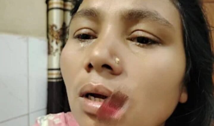 রাজবাড়ীতে ননদের কামড়ে ছিড়ে গেছে ভাবীর ঠোঁট
