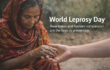 বিশ্ব কুষ্ঠ দিবস: সচেতনতা ও মানবিক সহমর্মিতাই প্রতিরোধের চাবিকাঠি