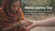 বিশ্ব কুষ্ঠ দিবস: সচেতনতা ও মানবিক সহমর্মিতাই প্রতিরোধের চাবিকাঠি