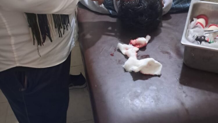 কিশোরগঞ্জ হাওরে নিজ জমিতে কাজ করতে গেলে  হামলার শিকার হন মোঃজহির মিয়া