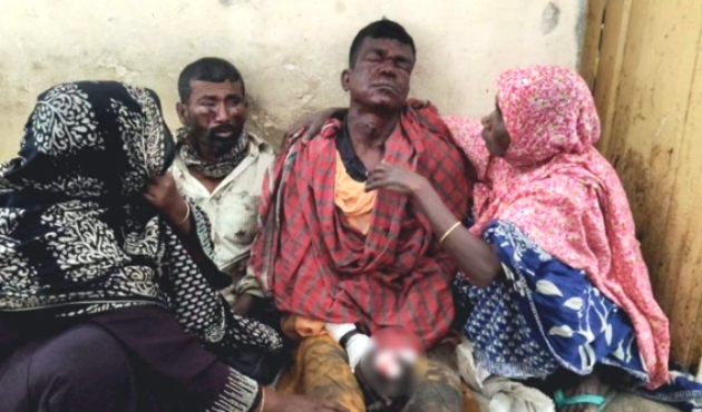 যশোরের শার্শা উপজেলায় মাটি কাটার সময় বোমা বিস্ফোরণ, দুই শ্রমিক গুরুতর আহত