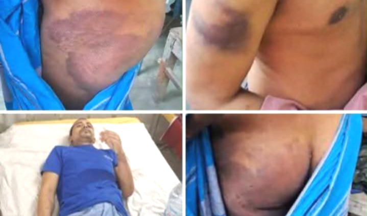 ধ্যযুগীয় পদ্ধতির ছায়া? গাইবান্ধা জিইউকে মাদকাসক্তি নিরাময় ও পুনর্বাসন কেন্দ্রকে ঘিরে চাঞ্চল্য!