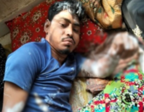 যশোরের শার্শা এলাকায় ট্রাকের ধাক্কায় সাইকেল আরোহী আহত