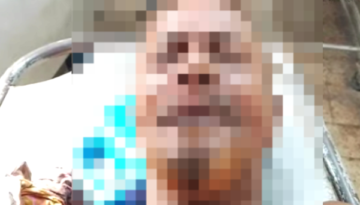 যশোর রামনগর এলাকায় রিকশাচালককে হাতুড়ি দিয়ে পিটিয়ে রিকশা ছিনতাইয়ের চেষ্টা