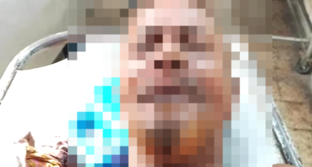 যশোর রামনগর এলাকায় রিকশাচালককে হাতুড়ি দিয়ে পিটিয়ে রিকশা ছিনতাইয়ের চেষ্টা