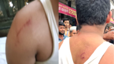 কুড়িগ্রাম পলিটেকনিকের ছাত্র শিবির  সভাপতির উপর ছাত্রদলের অর্তিকিত হামলা