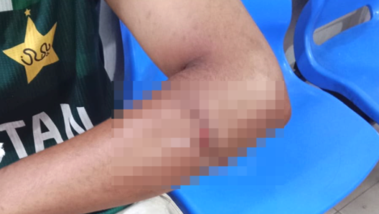 সান্তাহারে মুঠোফোনে ডেকে কলেজ ছাত্রকে কুপিয়ে জখম, থানায় অভিযোগ