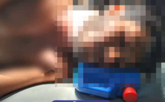 যশোর সদর উপজেলার সুলতানপুর এলাকায় বড় ভাই বটি দিয়ে কুপিয়ে জখম করেছে ছোট ভাইকে