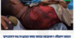 সুন্দরবনে মধু সংগ্রহের সময় বাঘের আক্রমণে মৌয়াল আহত