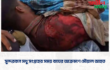 সুন্দরবনে মধু সংগ্রহের সময় বাঘের আক্রমণে মৌয়াল আহত